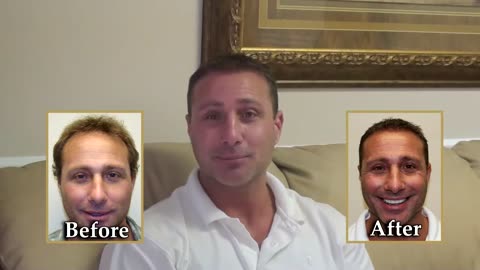 Dr. Brett Bolton Hair Transplant | Happy Patient Shares Amazing Results