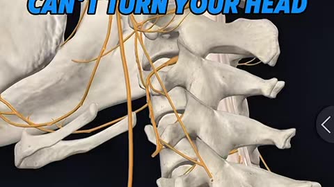 Why do I have chronic neck pain and loss of range of motion?