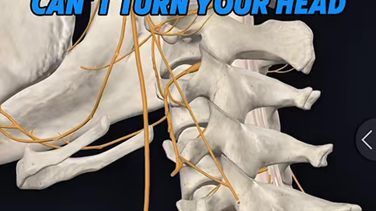 Why do I have chronic neck pain and loss of range of motion?