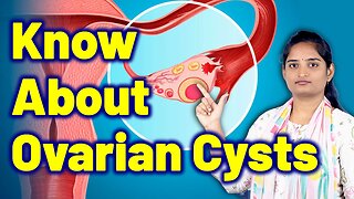 Know About Ovarian Cyst, Corpus Luteum Cyst, Ovary Cyst | Treatment Cure Medicine | Gynaecology