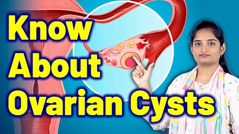Know About Ovarian Cyst, Corpus Luteum Cyst, Ovary Cyst | Treatment Cure Medicine | Gynaecology