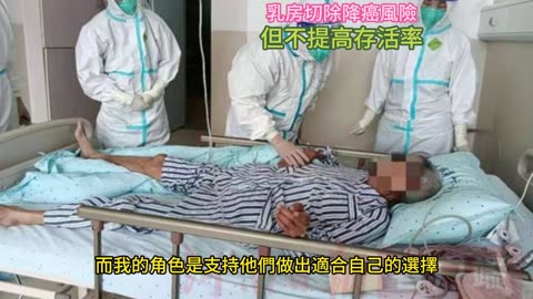 乳房切除降癌風險 但不提高存活率