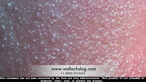Contact Dermatitis Dr Joel Wallach