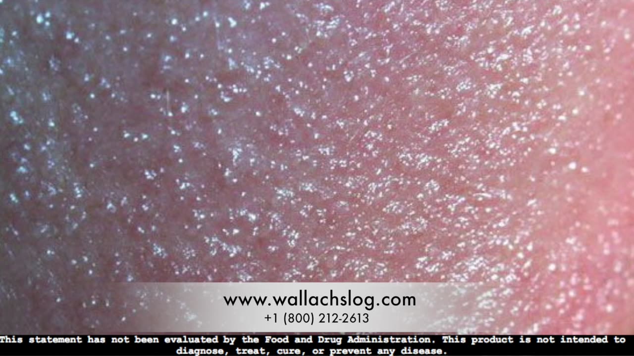 Contact Dermatitis Dr Joel Wallach