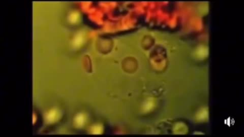 Cancer is a parasitic infection