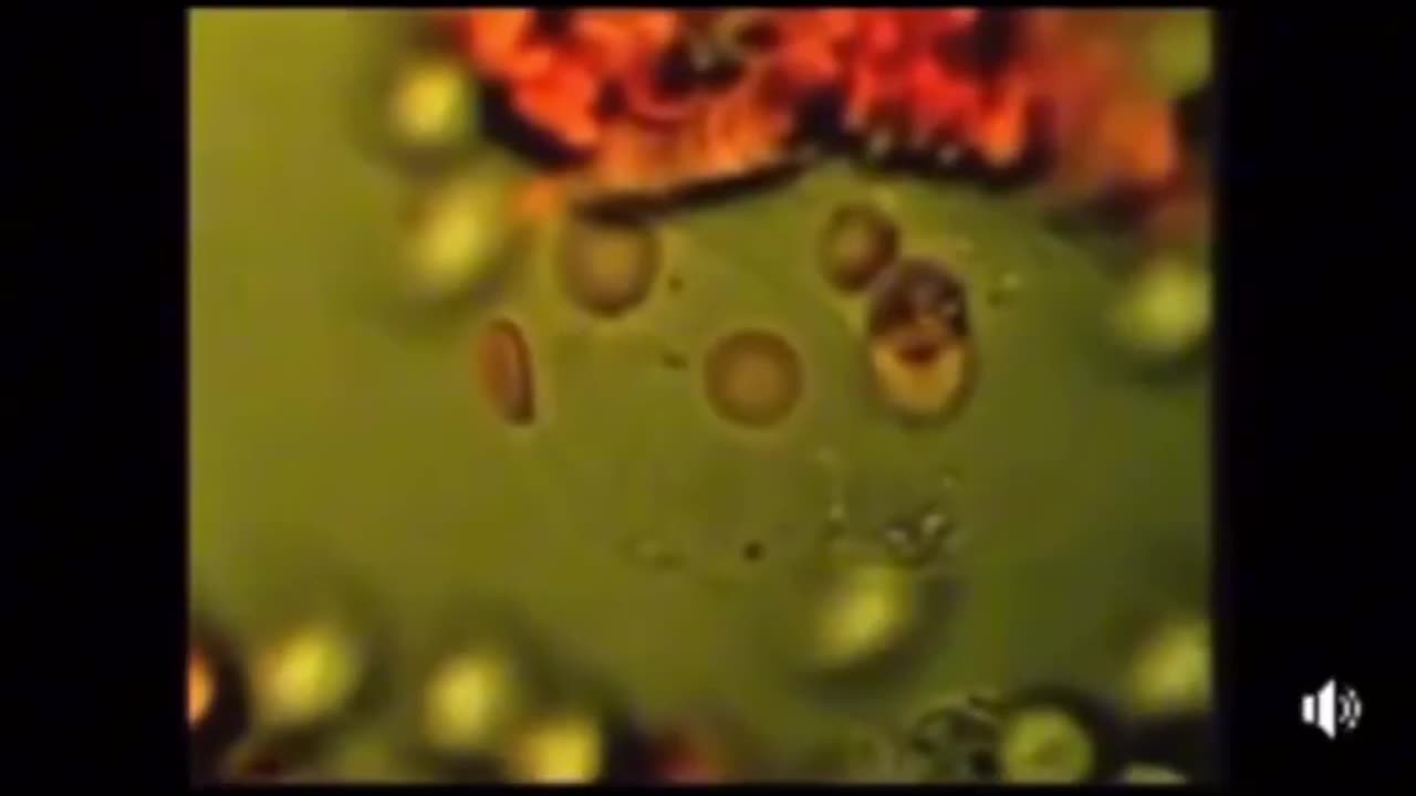 Cancer is a parasitic infection