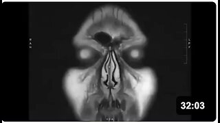 One PCR Test, One Man, and a Surprising Discovery