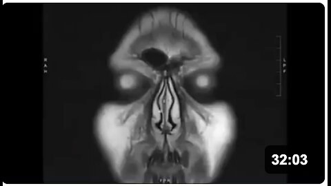 One PCR Test, One Man, and a Surprising Discovery