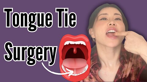 Tongue tied surgery