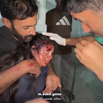 A Palestinian girl survived after being shot in the head by an Israeli drone