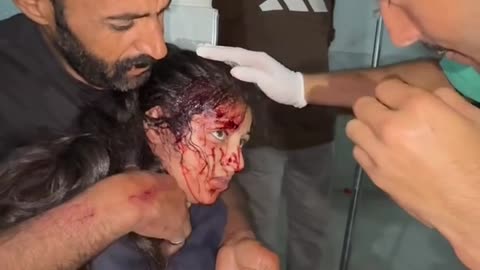 A Palestinian girl survived after being shot in the head by an Israeli drone