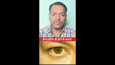 हेपेटाइटिस बी होने के कारण ।