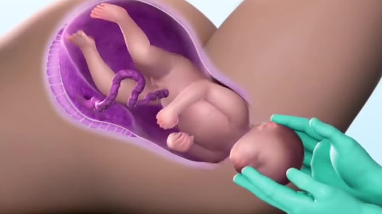Child Birth Process 3D Animation