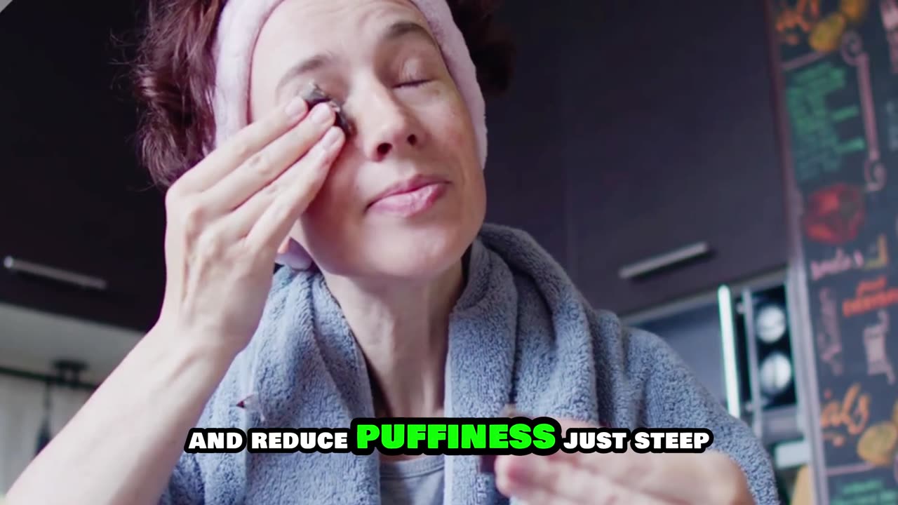 How to Get Rid of Dark Circles Naturally at Home 🌿 | Easy Skincare Tips That Work