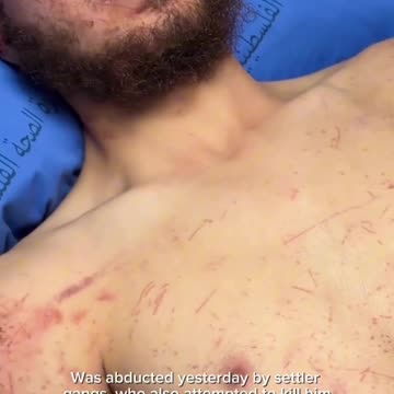 West Bank | Palestinian young man Owais Hammam