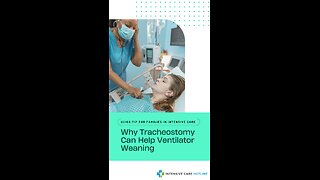 Why Tracheostomy Can Help Ventilator Weaning