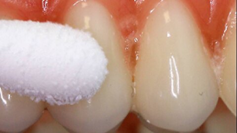 Mix Your Own “Dental Elixir” At Home And Rebuild Your Teeth Twice As Fast...