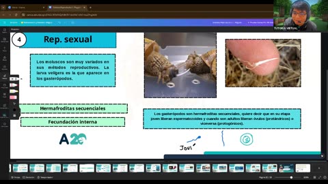 AULA 20 REGULAR 2025 - 1 | Semana 15 | Anatomía