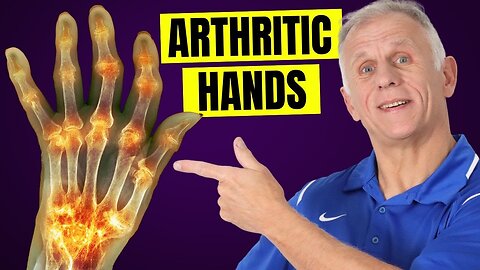 8 Tips to Reduce Hand Arthritis Pain (Physical Therapy Approved)