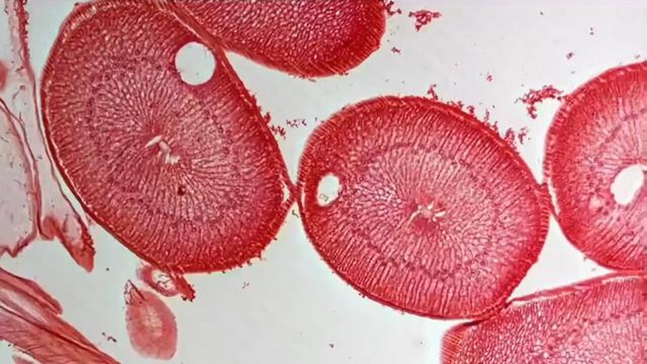 Everything That Cancer Likes...Parasites Like. Everything Cancer Hates...Parasites Hate