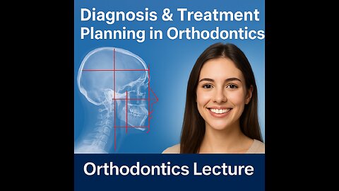 Orthodontic Biomechanics & Treatment Considerations