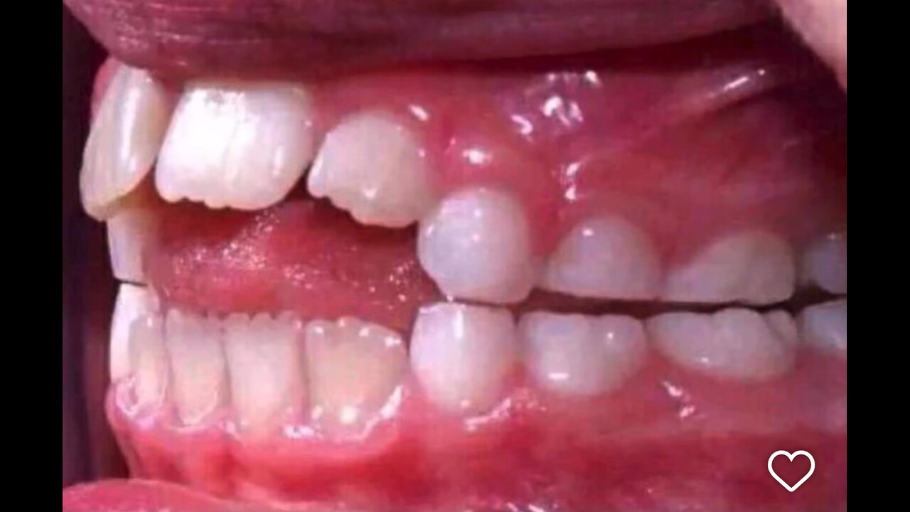 3 cap breakers !! chirpbol1 on twitch/rumble , chirpbol on youtube/kick/tiktok/facebook