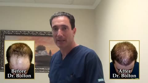 Dr. Brett Bolton Hair Restoration | Corrective Hair Surgery Results