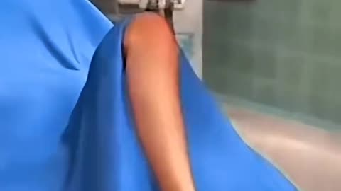 Ilizarov Procedure — Bone Lengthening & Deformity Correction Explained