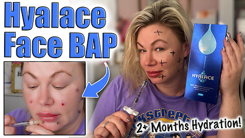 Hyalace is BACK IN STOCK! Full Face BAP! Acecosm and code Jessica10 Saves