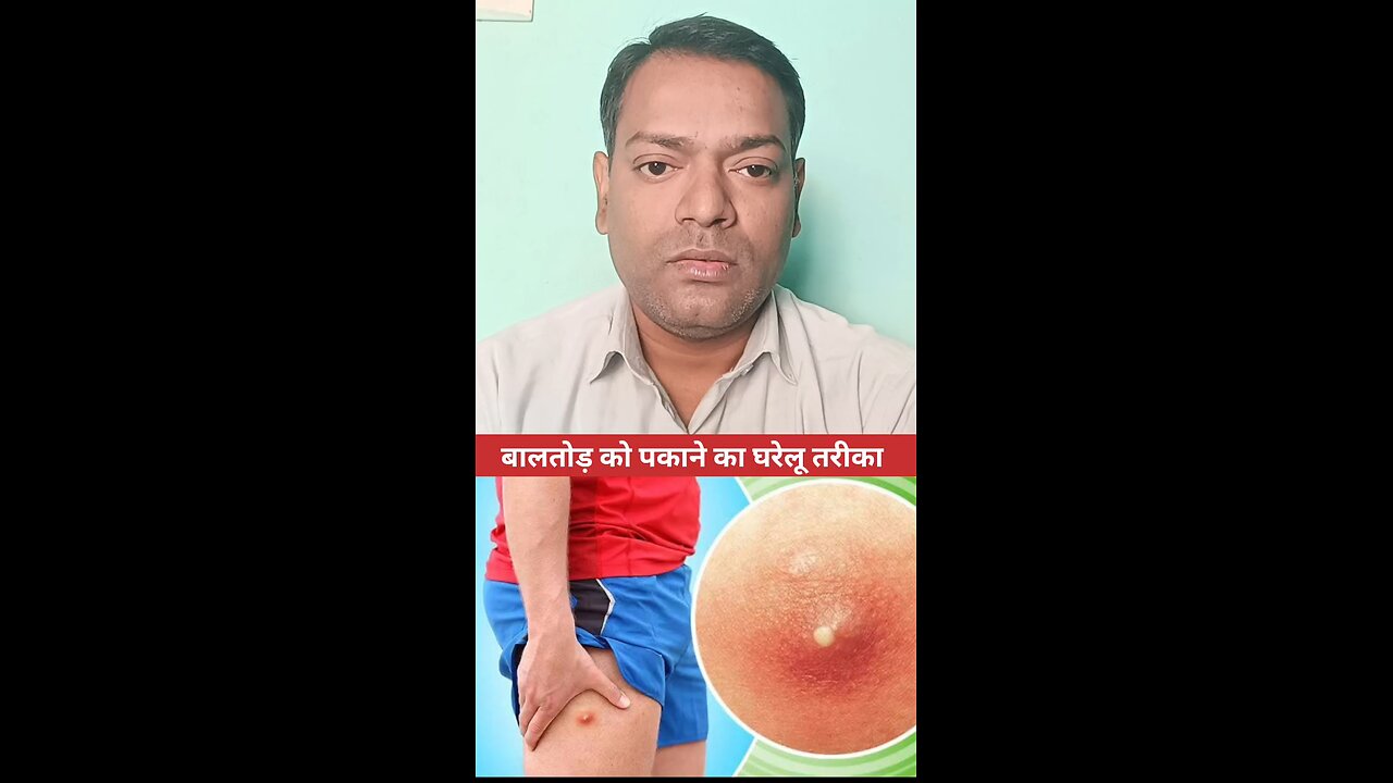 बालतोड़ को पकाने का घरेलू तरीका ।