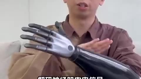 BIONIC PROTHESIS