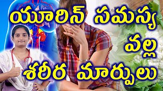 యూరిన్ సమస్య శరీర మార్పులు Body Changes In Urinary Tract Infection UTI Homeopathy Treatment Mdicine