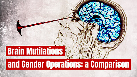 Biggest Medical Crime in the US: Lobotomy vs. Gender Surgery | www.kla.tv/36750