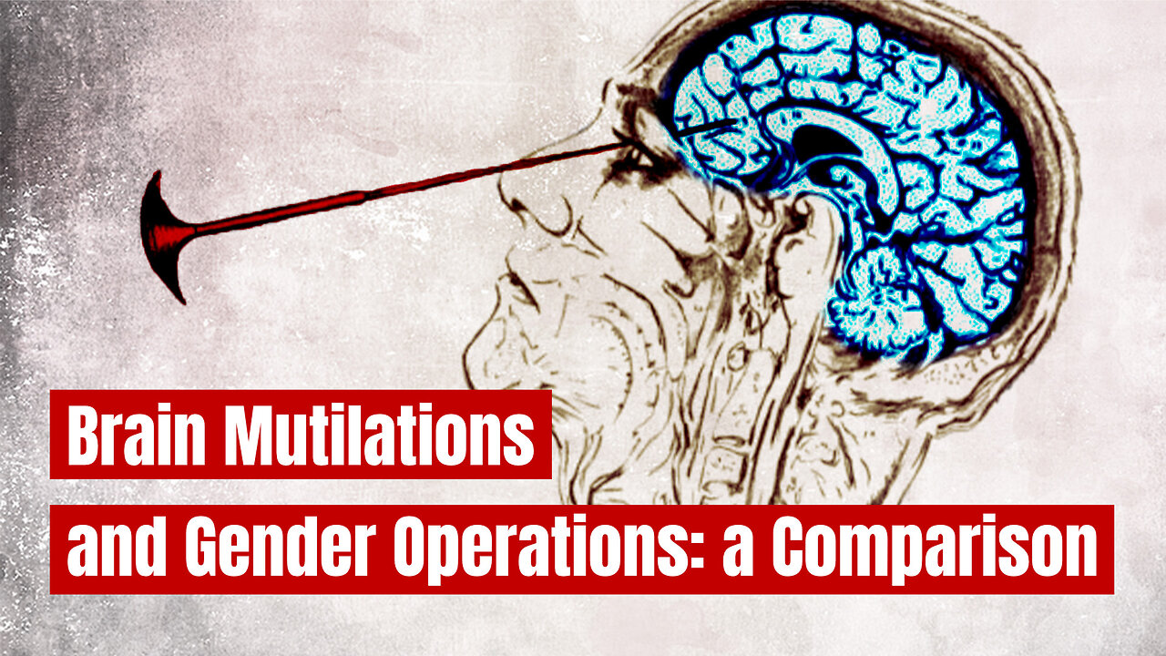 Biggest Medical Crime in the US: Lobotomy vs. Gender Surgery | www.kla.tv/36750