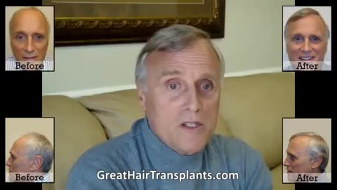 Satisfied Hair Transplant Patient Shares Amazing Results