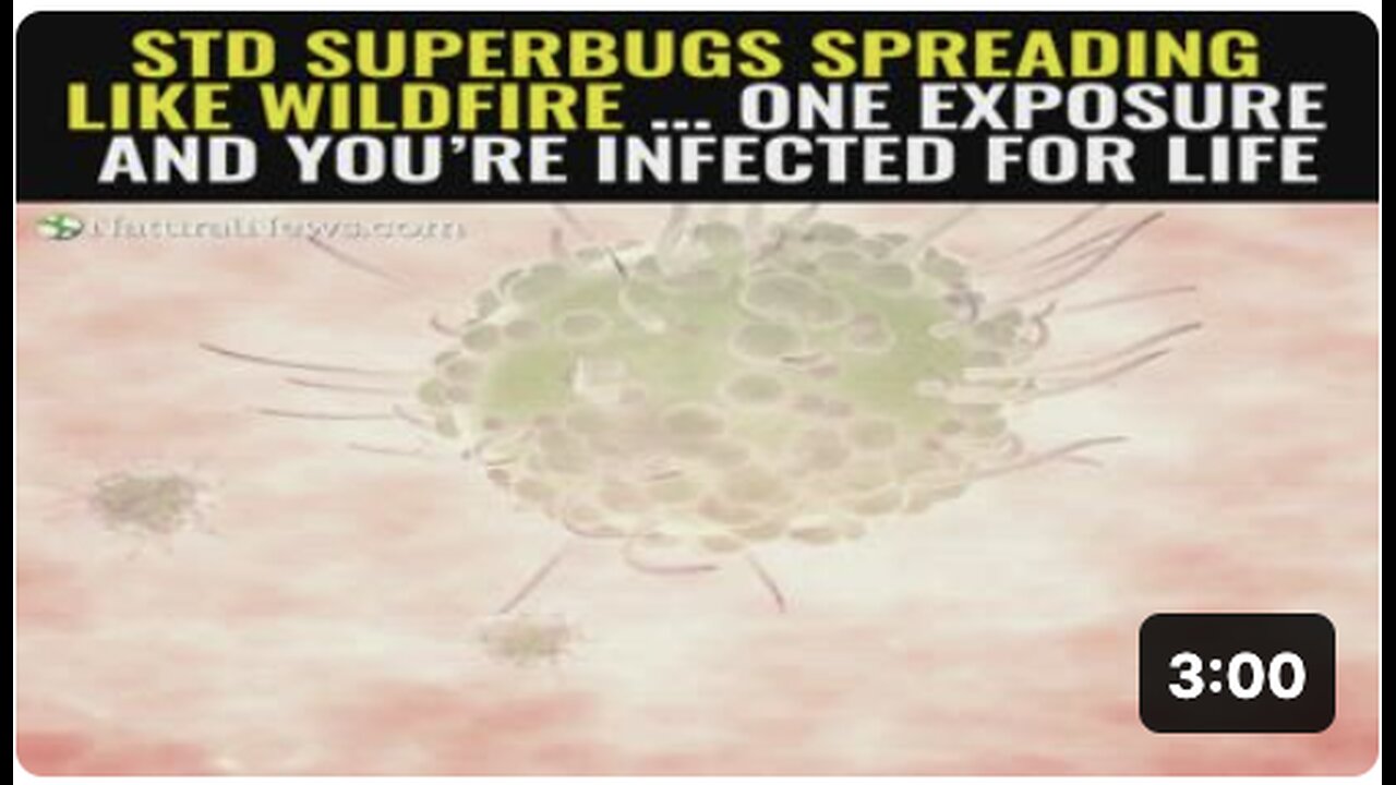 STD superbugs spreading like wildfire … One exposure and you’re infected for life