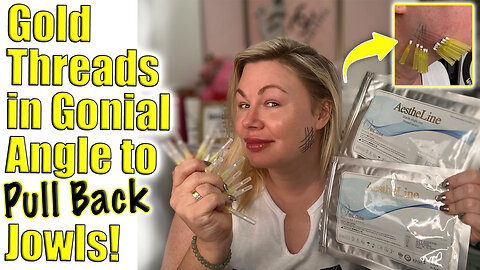 Gold Threads in Gonial ANgle to PULL BACK Jowls! AceCosm.com and code Jessica10 Saves