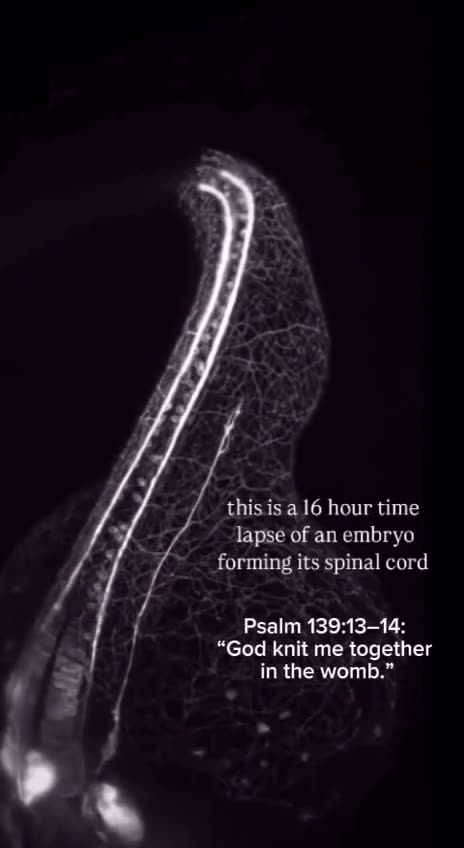 Psalm 139:13-14: God knit me together in the womb.