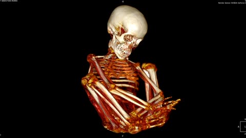 🤯👽 Mysterious Medical Scan of Sebastian - What Do You Think? | TheTruthAbove