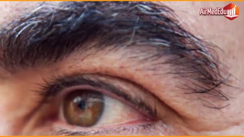 21 Alimentos para evitar la degenaración macular de la retina