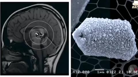 A comprehensive breakdown of the science behind the Pineal Gland (Third eye)