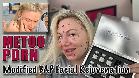 Metoo PDRN, Modified BAP Face Rejuvination! Maypharm.net and code Jessica10 saves you money