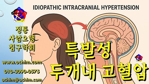 특발성 두개내 고혈압 치료 후기 - 사암침법, 사암오행침, 오행침, 정통사암침