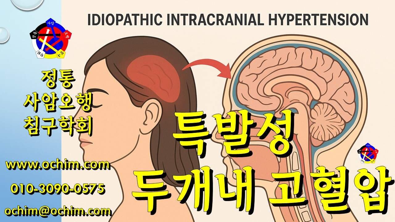 특발성 두개내 고혈압 치료 후기 - 사암침법, 사암오행침, 오행침, 정통사암침