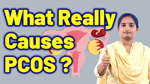 Risk Factors & Causes For PCOS Polycystic Ovarain Syndrome Infertility Homeopathy Medicine Cure