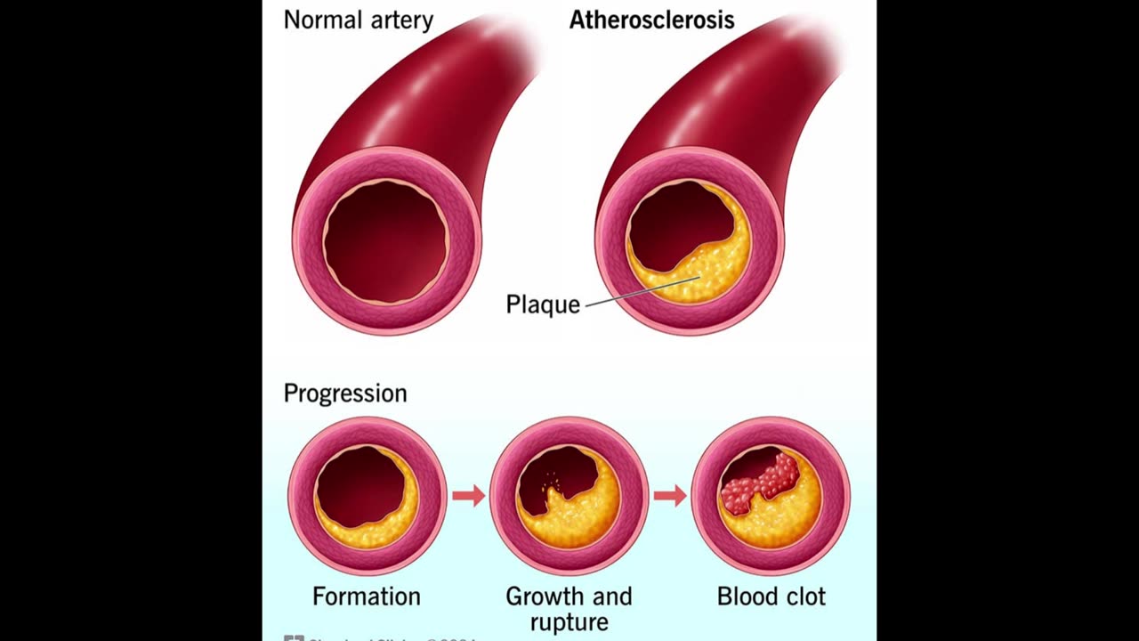 HIGH CHOLESTEROL & Whole Orange Benefits