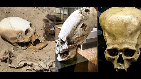 THEY WERE HUMANOID BUT NOT LIKE US! CAN YOU HANDLE THE TRUTH?