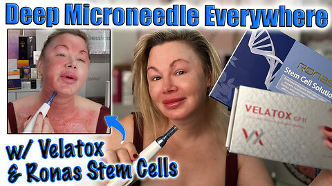 Deep Microneedle EVERYWHERE w/ Velatox & Ronas Stem Cell Solution! AceCosm.com code Jessica10