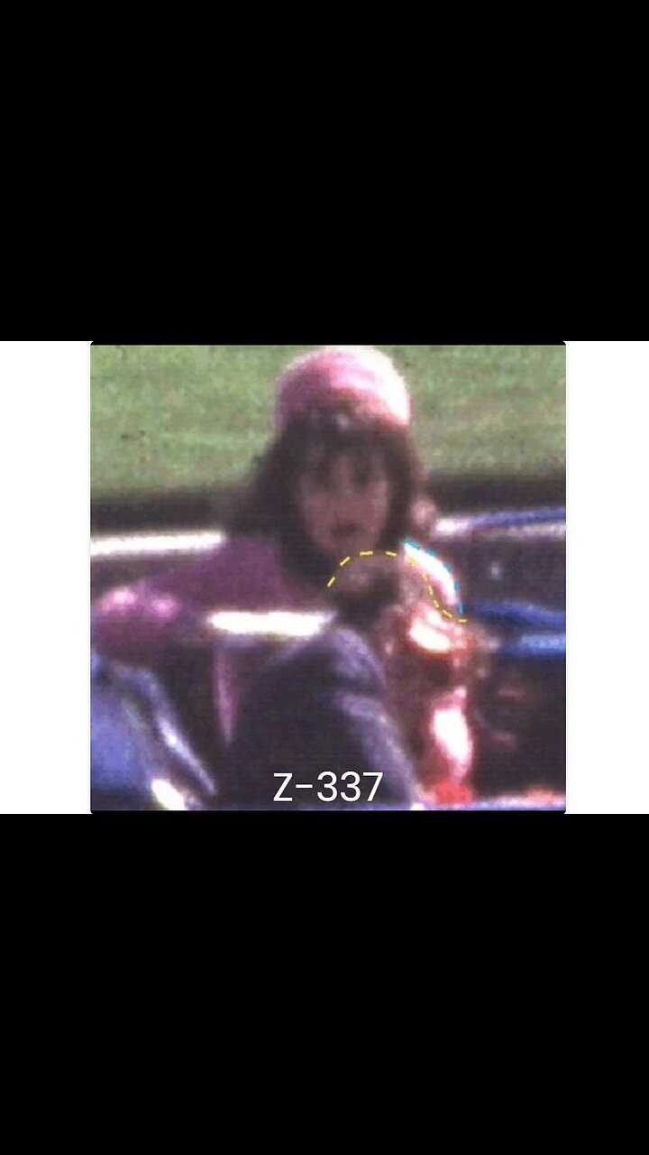 CONCLUSIVE VISUAL EVIDENCE OF ZAPRUDER FILM ALTERATION -- J. KEVEN HOFELING 11/7/2025
