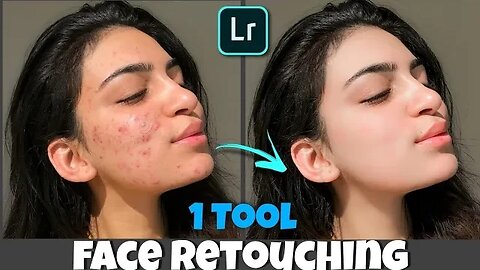 Face Retouching | Pimple Remove In Lightroom | In 2 Minutes | With Just One Tool